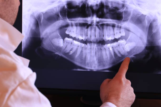 Best Pediatric Emergency Dentist in Jacksboro, TN
