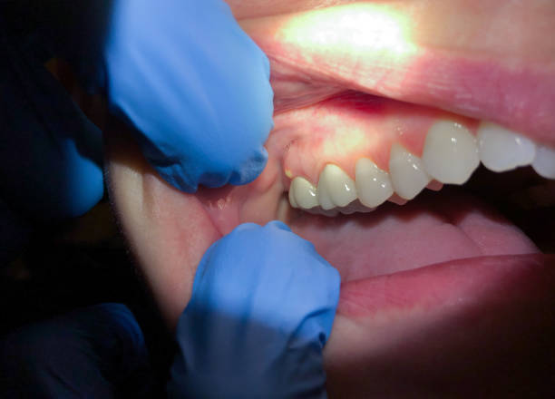 Best Emergency Dentist for Special Needs Patients in Jacksboro, TN