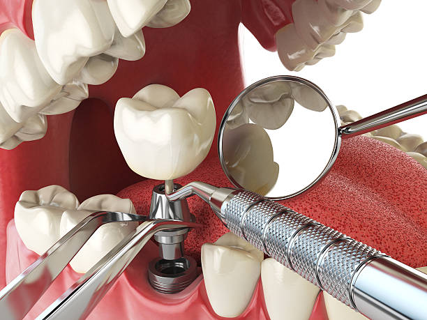 Best Emergency Dental Services for Seniors in Jacksboro, TN